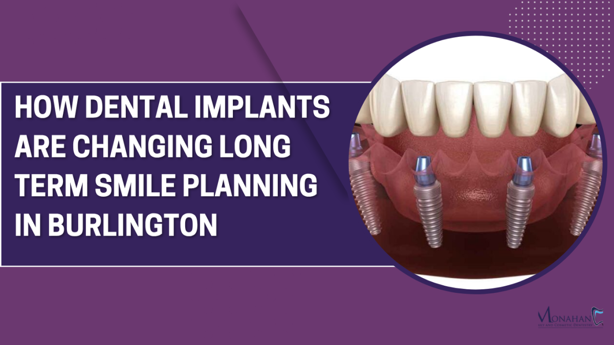 How Dental Implants are Changing Long Term Smile Planning in Burlington
